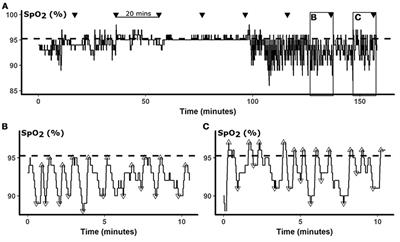 Oxyhemoglobin Saturation Overshoot Following Obstructive Breathing Events Mitigates Sleep Apnea-Induced Glucose Elevations